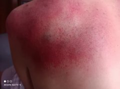 小儿推拿 美容瘦身 身体调理