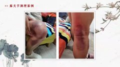 小儿推拿 美容瘦身 身体调理